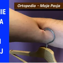 Zerwanie bicepsa w części dalszej. Ramię z wieszakiem, sugerujące uraz. Ortopedia – Moja Pasja #028.