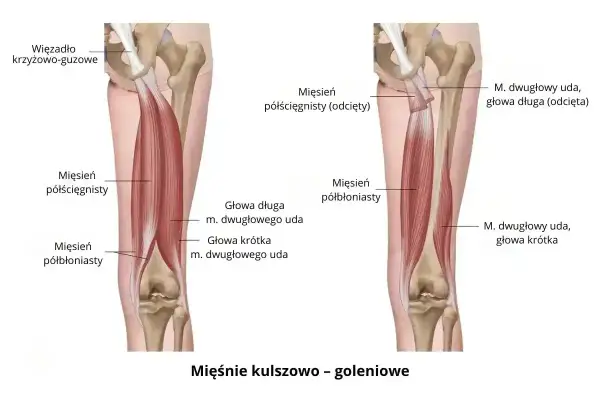 Anatomia mięśnia dwugłowego uda, pokazująca jego głowy długą i krótką oraz mięśnie półścięgnisty i półbłoniasty.